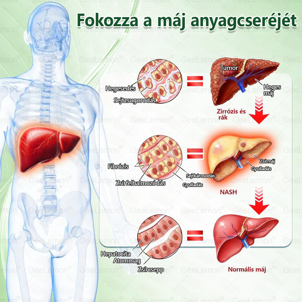 Gratulálunk! Ön lett a mai 500. vásárló. Különleges ajánlatként egy további Geelemon® terméket 50% kedvezménnyel vásárolhat meg!