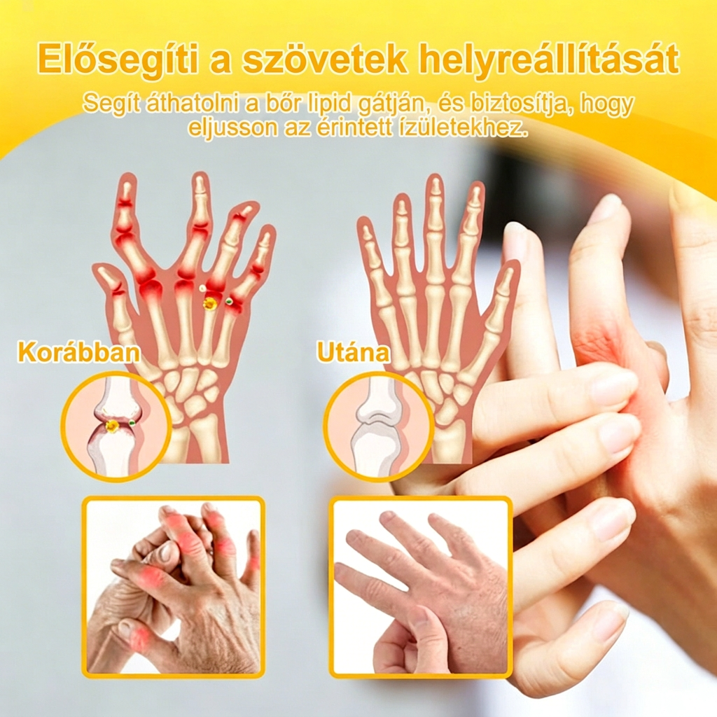 HU DR.HONOR® All-In-One Ízületi és Csontápoló Krém (Kifejezetten idősebb felnőttek számára)