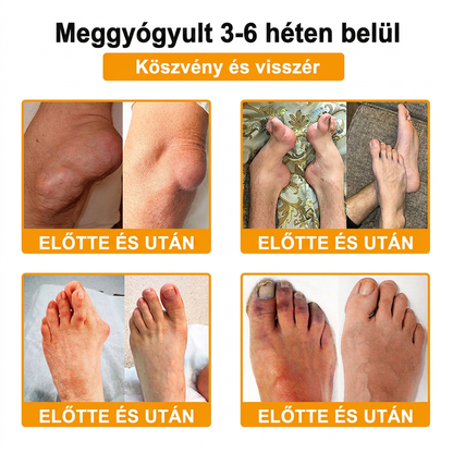 HU DR.HONOR® All-In-One Ízületi és Csontápoló Krém (Kifejezetten idősebb felnőttek számára)