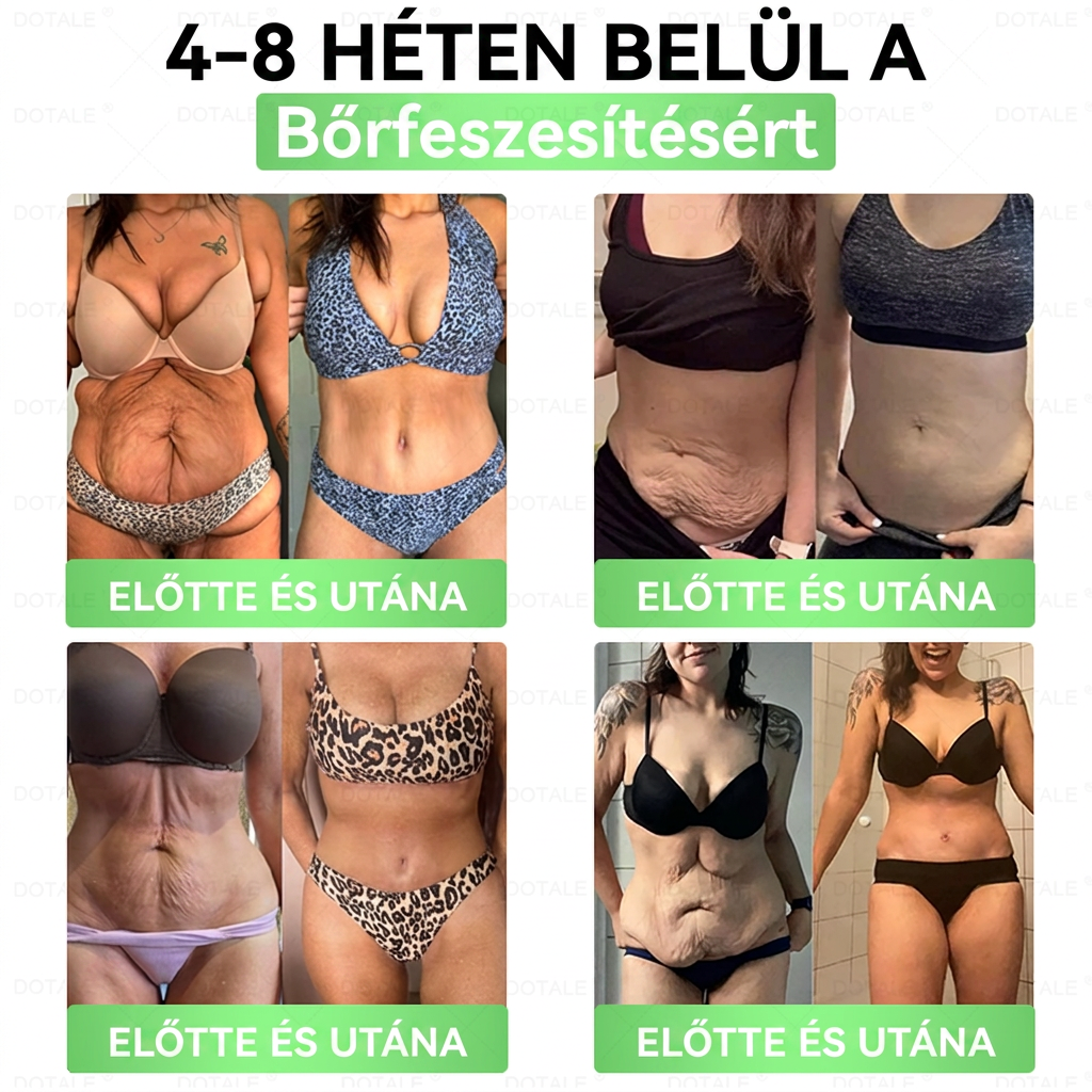 Gratulálunk! Ön lett a mai 500. vásárló. Különleges ajánlatként egy további DOTALE® terméket 50% kedvezménnyel vásárolhat meg!