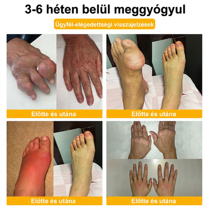 HU DR.HONOR® All-In-One Ízületi és Csontápoló Krém (Kifejezetten idősebb felnőttek számára)