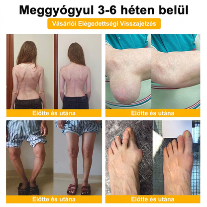 HU DR.HONOR® All-In-One Ízületi és Csontápoló Krém (Kifejezetten idősebb felnőttek számára)