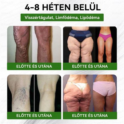 Gratulálunk! Ön lett a mai 500. vásárló. Különleges ajánlatként egy további DOTALE® terméket 50% kedvezménnyel vásárolhat meg!