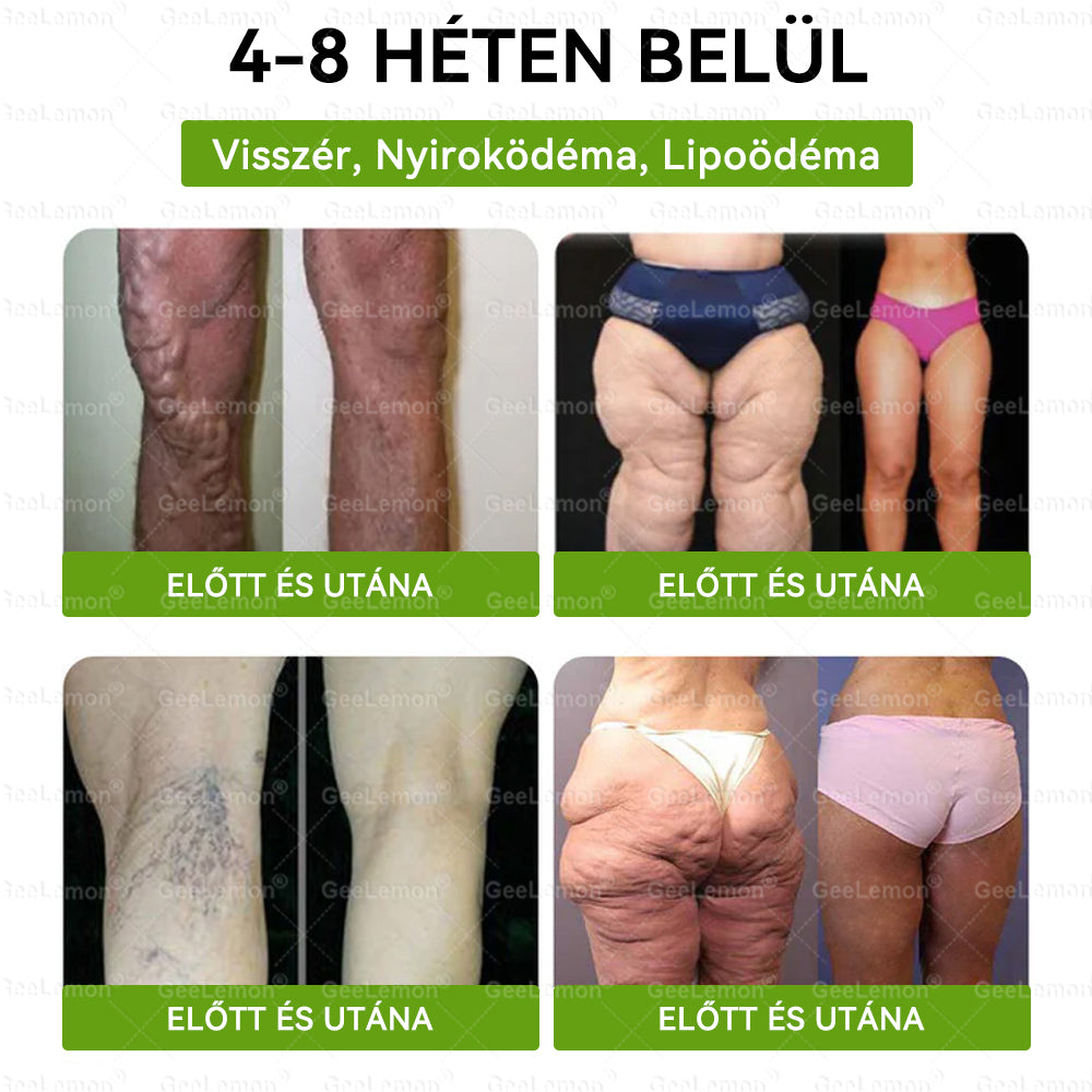 Gratulálunk! Ön lett a mai 500. vásárló. Különleges ajánlatként egy további Geelemon® terméket 50% kedvezménnyel vásárolhat meg!